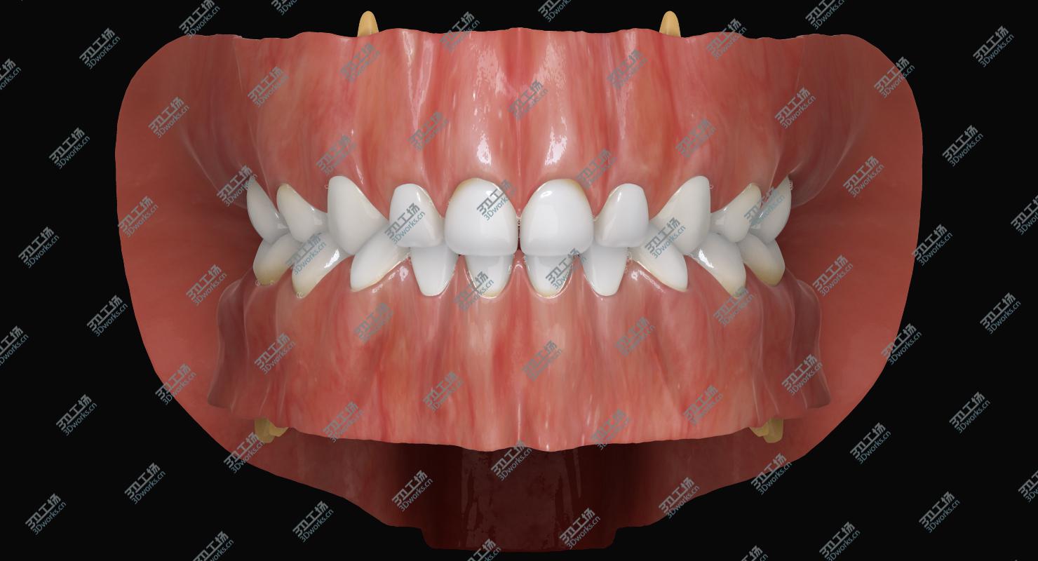 images/goods_img/2021040161/Primary Mouth/4.jpg